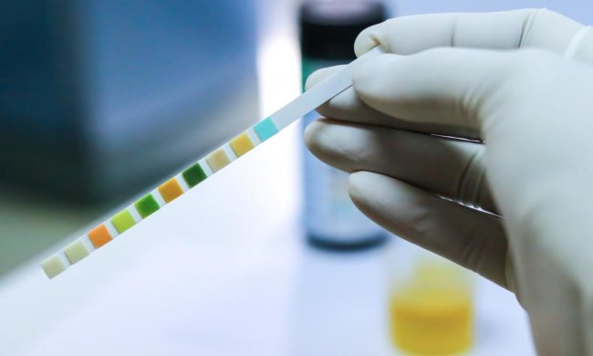 Онкологи створили найточніший тест на рак за аналізом сечі