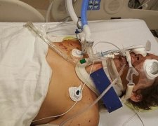 Хлопець відсвяткував День незалежності саморобним феєрверком та втратив ногу