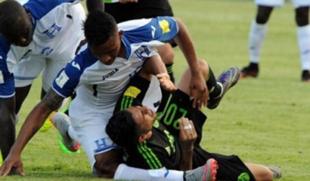 Футболист сборной Гондураса сильно травмировал ногу (видео)