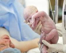 Як відіб'ється кесарів розтин на майбутньому дитини