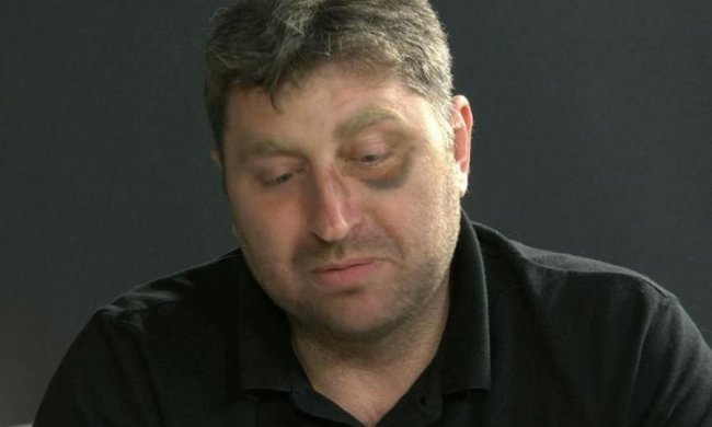Заради забави луганському депутату підкинули відрізану голову 