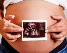 300 вагітних американок заразилися вірусом Зіка