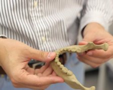 Організм сприймає за свої: українці навчилися друкувати кістки