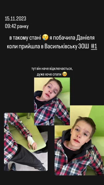 Пострадавший ребенок, фото: Facebook