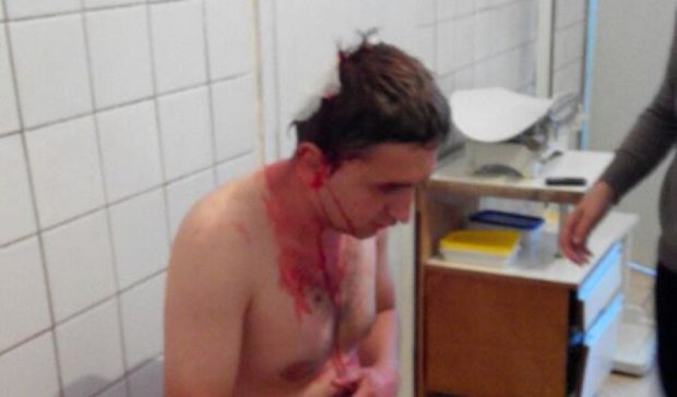  На Житомирщині побили активіста, який боровся з бурштиновою мафією