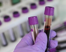 аналіз крові