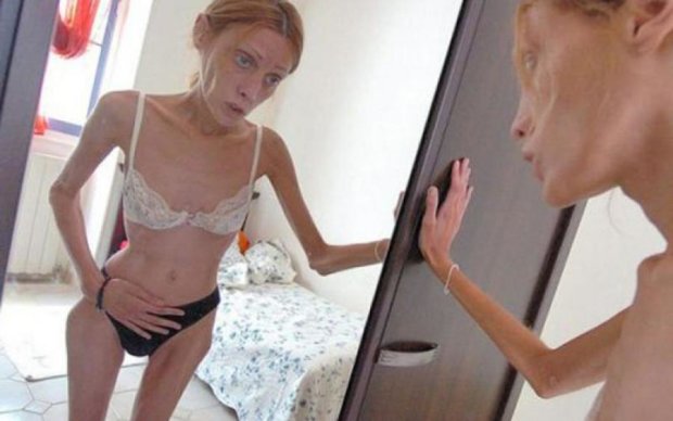 Голые девушки с анорексией (63 фото) - порно и фото голых на optnp.ru