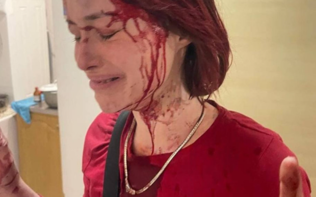 Сотрудник ТЦК жестоко избил девушку: суд фактически закрыл глаза на преступление