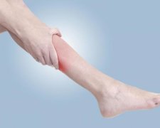 Ногу звело: як позбутися судоми