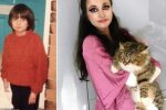 С таким диагнозом многие не доживают и до 5 лет, а она отметила 35: девушка имеет кожу бабочки и страдает каждый день