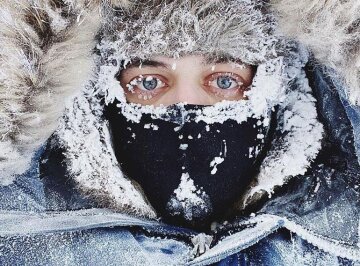 Обморожение