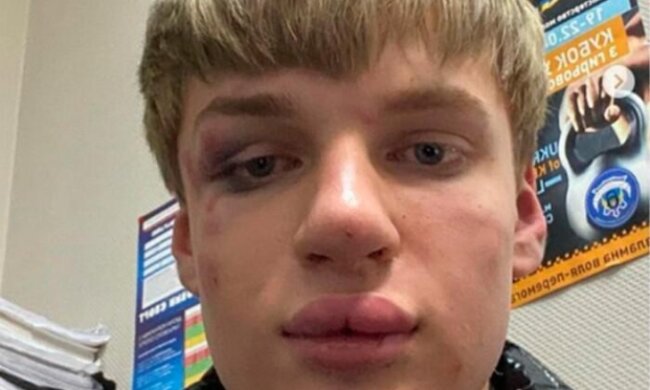 Скрін, Facebook