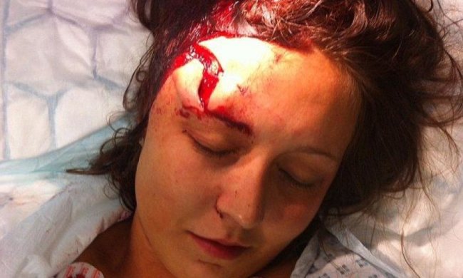 В Червонограді майор поліції розбив жінці голову