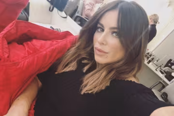 Лорак схвилювала фанатів дивним обличчям: "Схожа на Майкла Джексона"