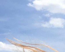 Втратила ногу, але не дух: історія дівчини з протезом зворушила мережу