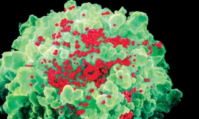 Нова вакцина від ВІЛ допомогла першим пацієнтам