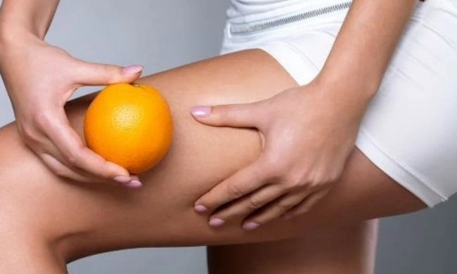 Целюліт, зображення з вільних джерел