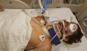 Хлопець відсвяткував День незалежності саморобним феєрверком та втратив ногу