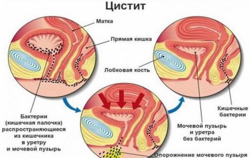 Медики розповіли, як поліпшити жіноче здоров’я за допомогою звичайної води