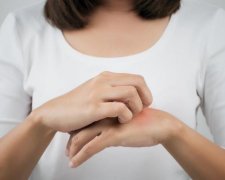 Як позбутися сверблячки після укусу комара: 6 простих порад