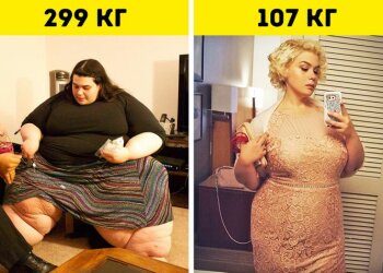 Важила 299 кілограм: дівчина взяла себе в руки і стала іншою людиною - історія великої перемоги