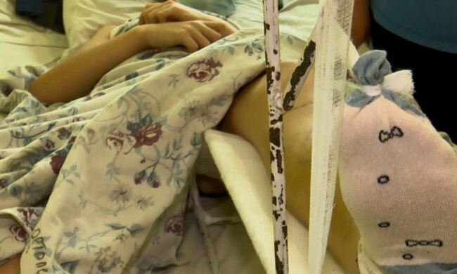 Шестикласник зламав ногу, фото: usionline.com