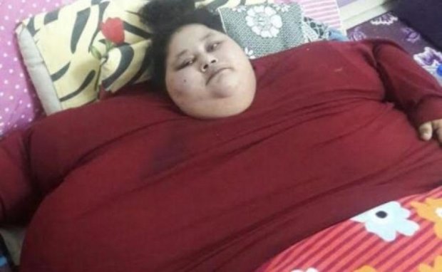 Самая толстая женщина планеты неожиданно сдулась
