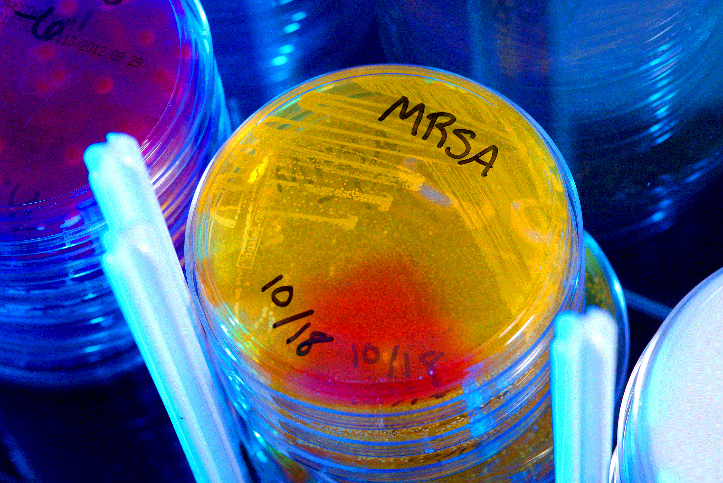 Микробиологи научились предсказывать вспышки суперинфекций